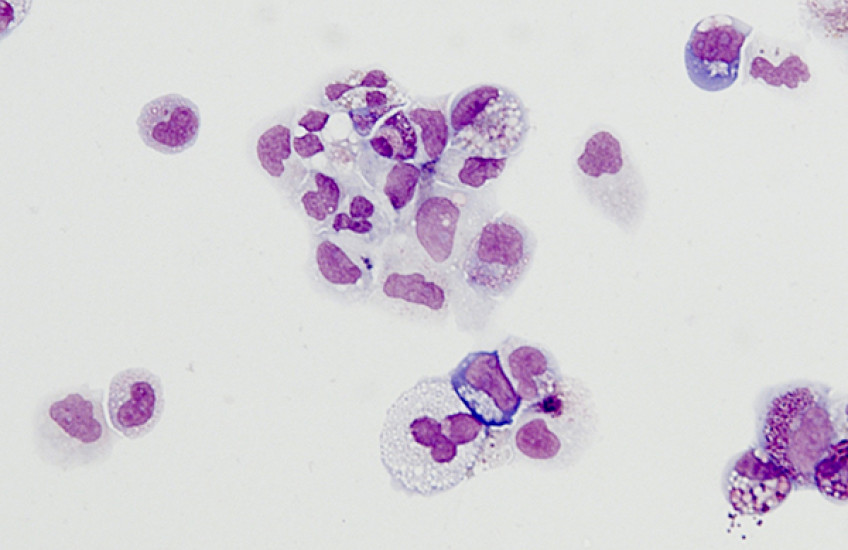 Stem Cells Step Forward