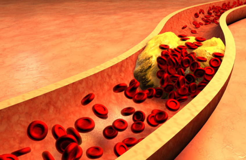 MicroRNAs and Metabolism 