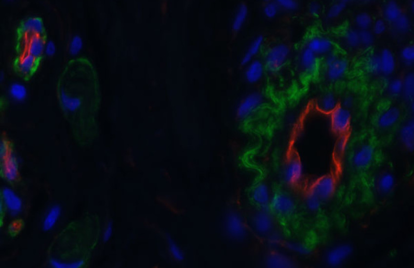 Endomucin expression in normal, non-injured tissue.
