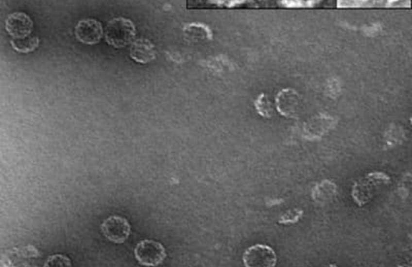 A transmission electron micrograph shows a pure preparation of encapsulin nanocompartments with cross-sections of individual capsids magnified on the top.