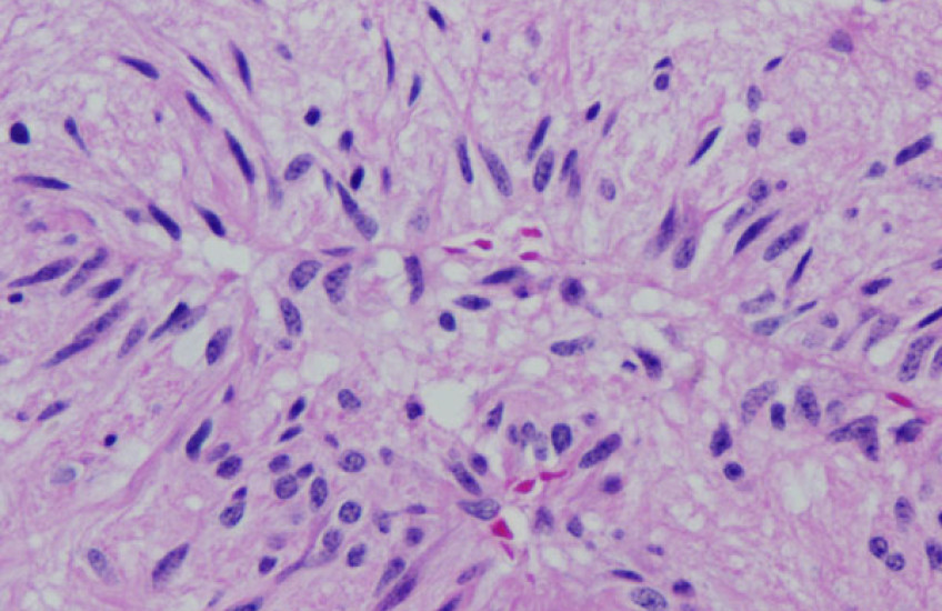 Signature Diagnosis