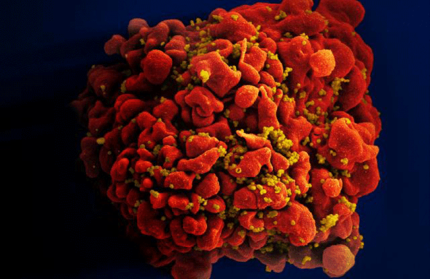 HIV Paradox