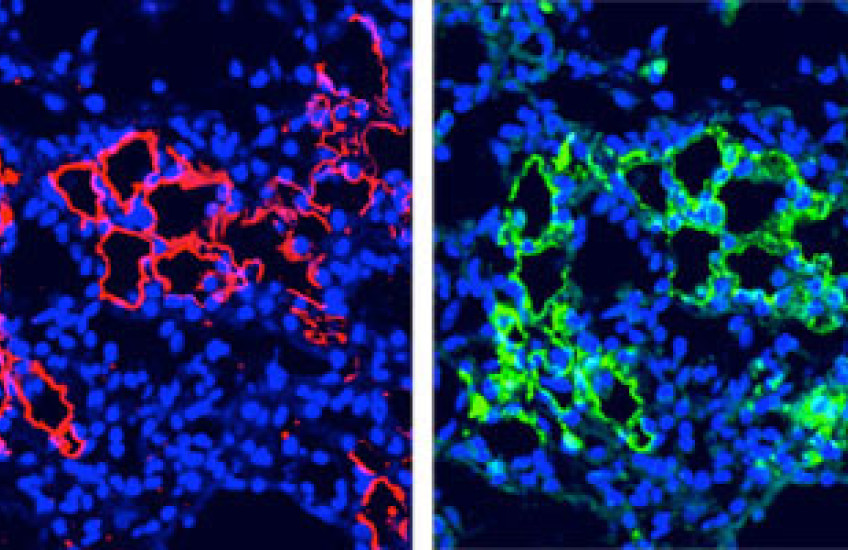 Lung Stem Cells Offer Therapeutic Clues