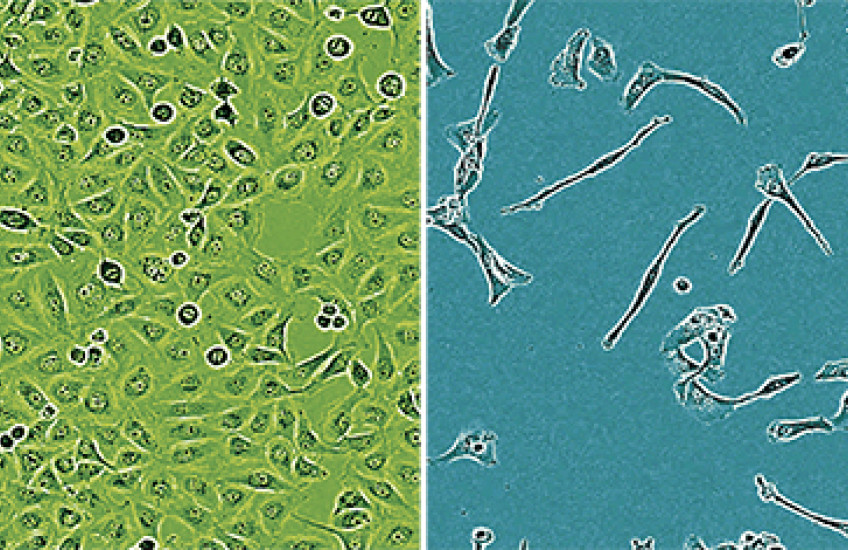 Halting Intracranial Tumor Growth