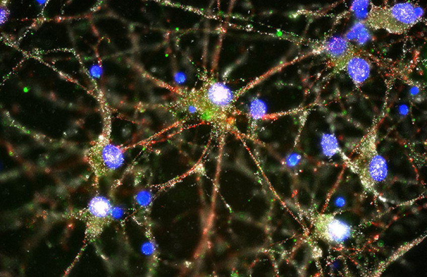 Imaging showing C4 (in green) located at the synapses of primary human neurons.
