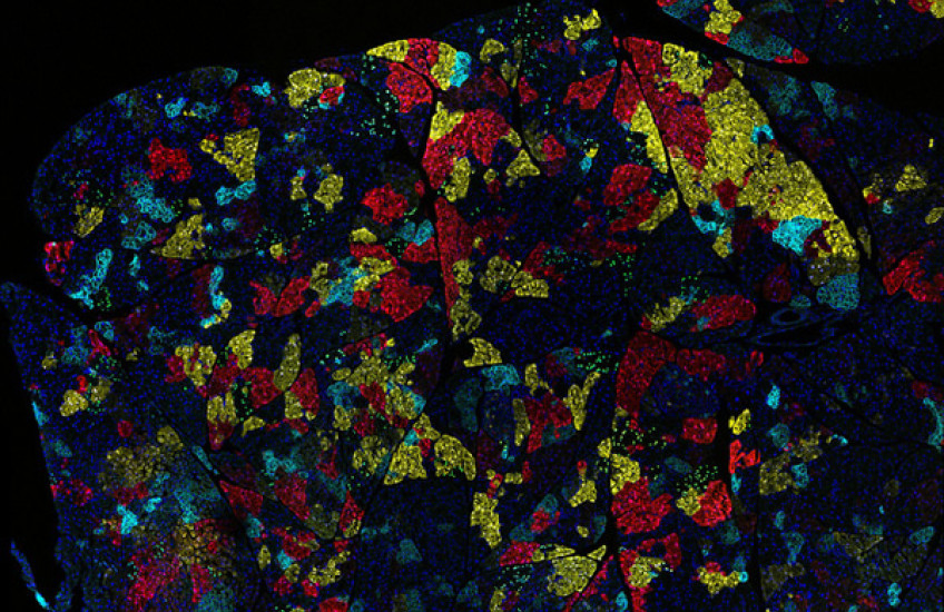 Testing Tumors