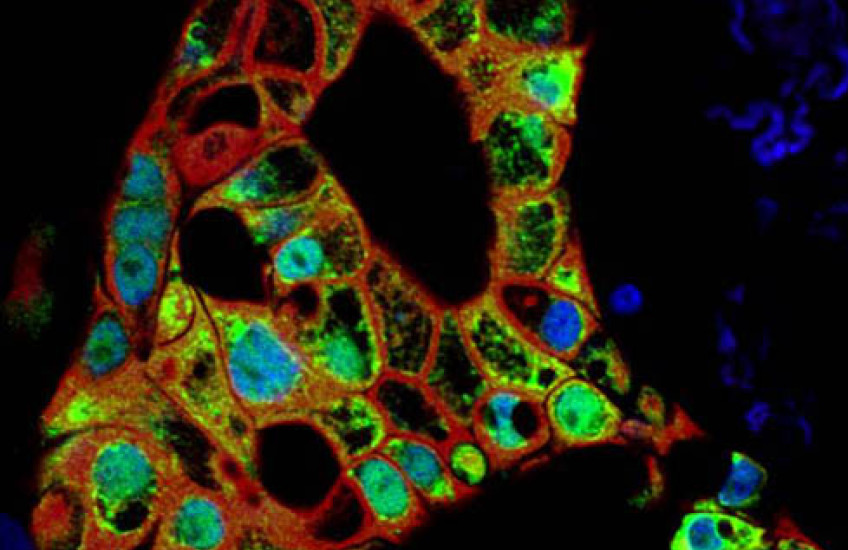 This Year’s Modeling