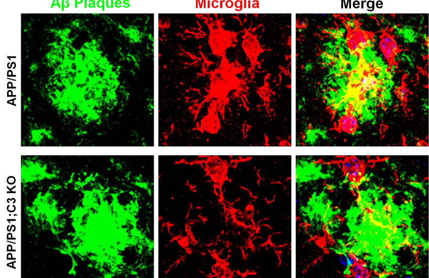 Alzheimer’s-Immunity Link