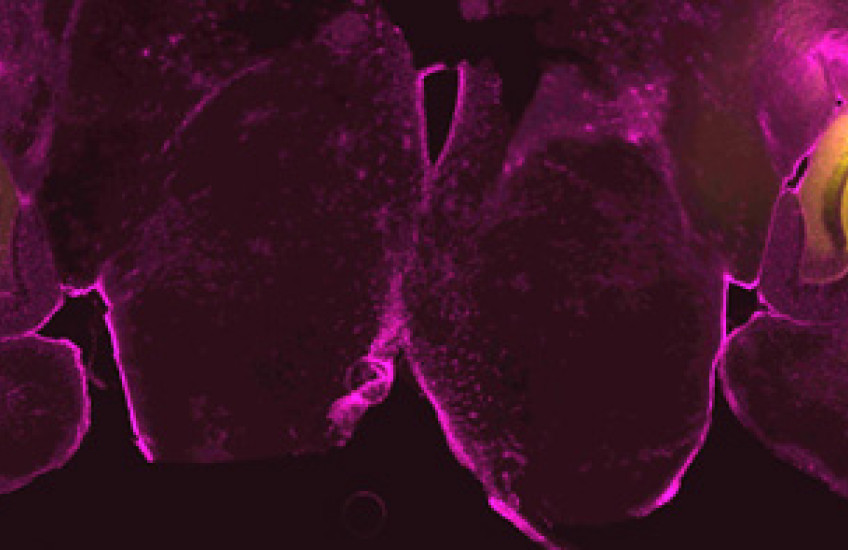 Synaptic Amplifier