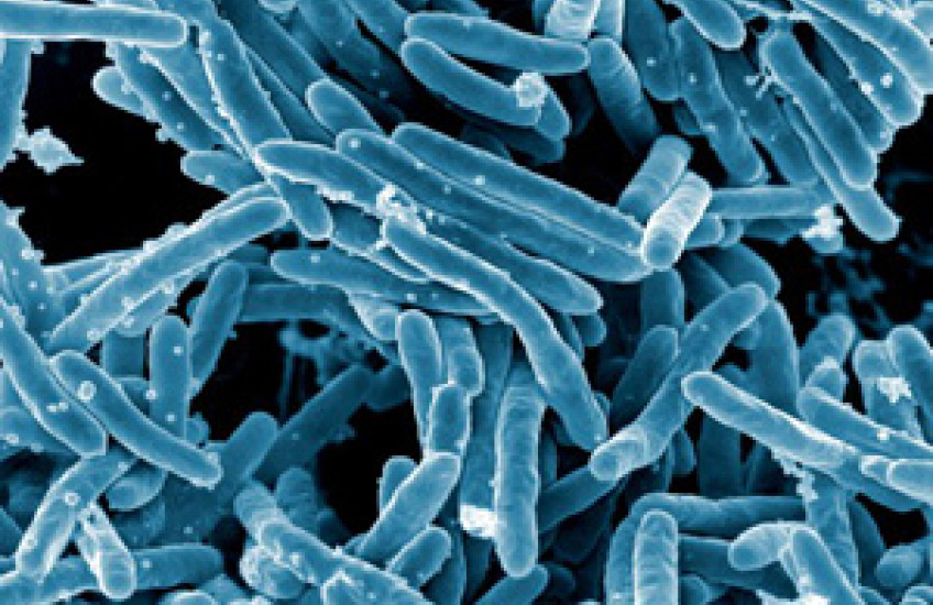 Making a Difference in TB