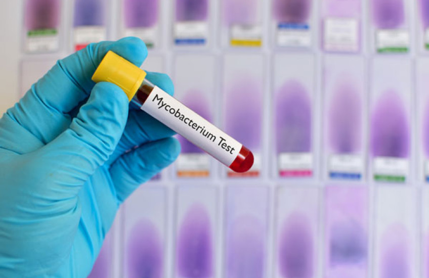 Predicting TB's Behavior