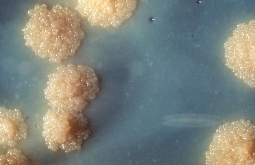 New Blood for TB Treatment