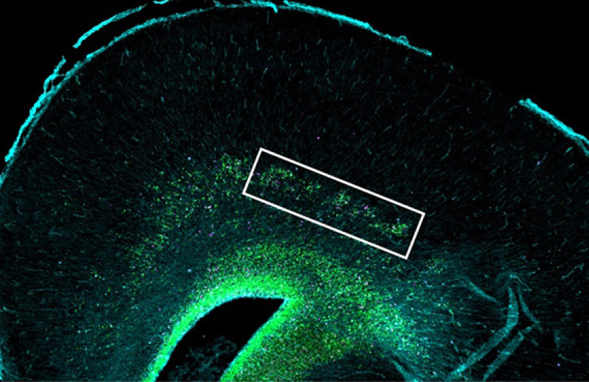 Big Brains, Little Brains