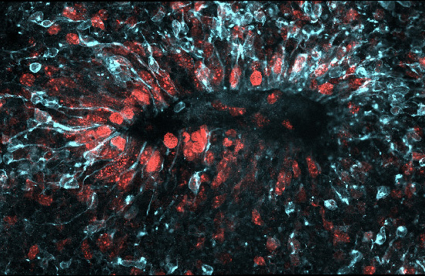 Zika’s Entry Points