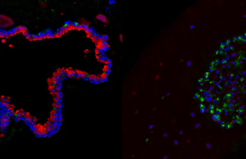 Listening In on Lung Cells