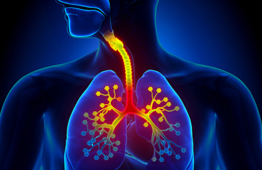 Asthma Cross Talk 