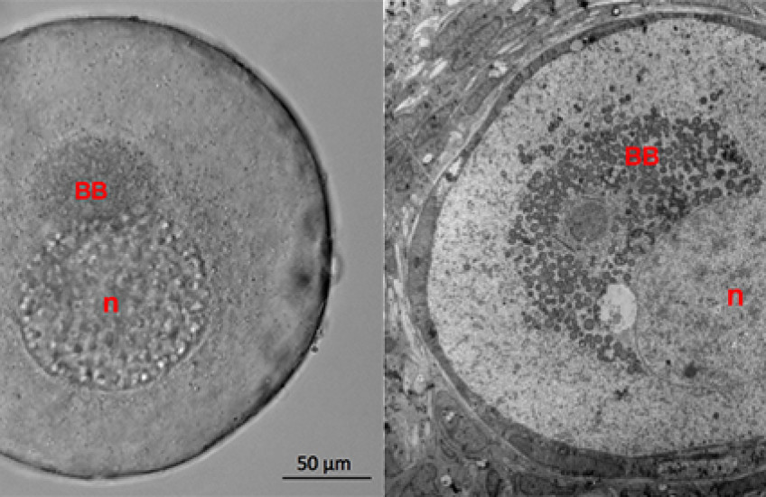 Inside Balbiani Bodies
