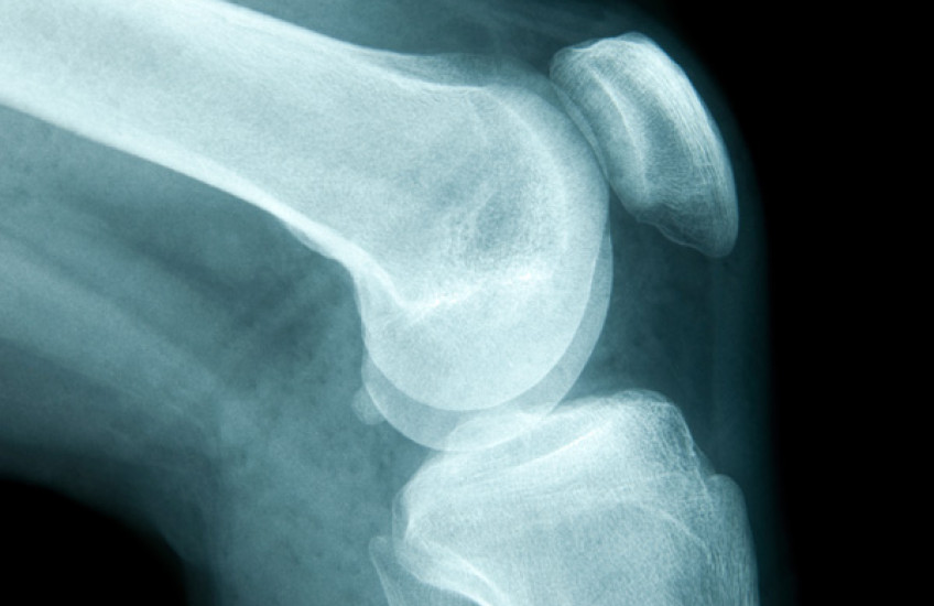 Building Better Bone