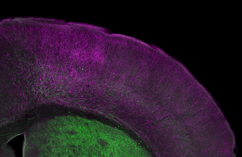 Synaptic Shortcut