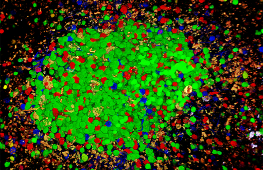 Battle of the B Cells