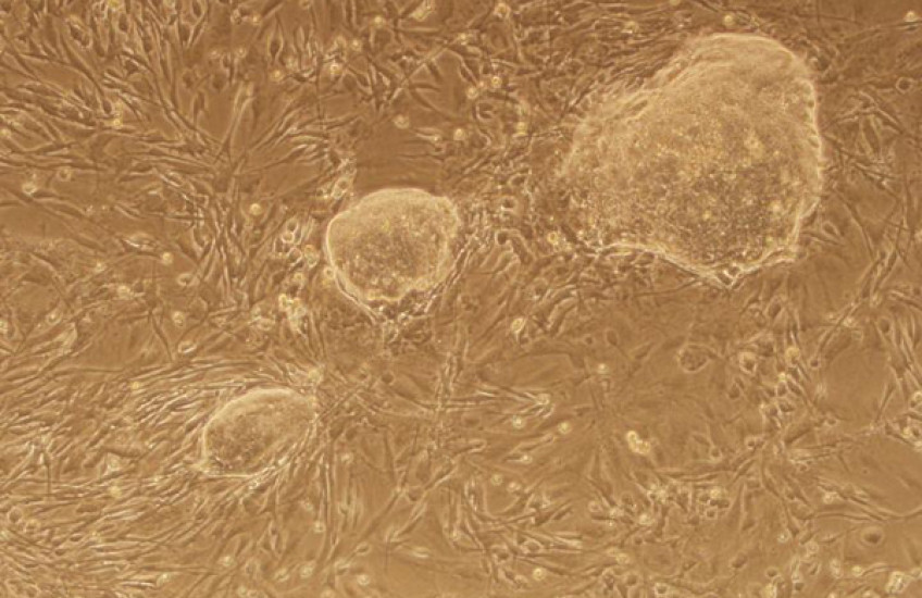 Stem Cell Memory