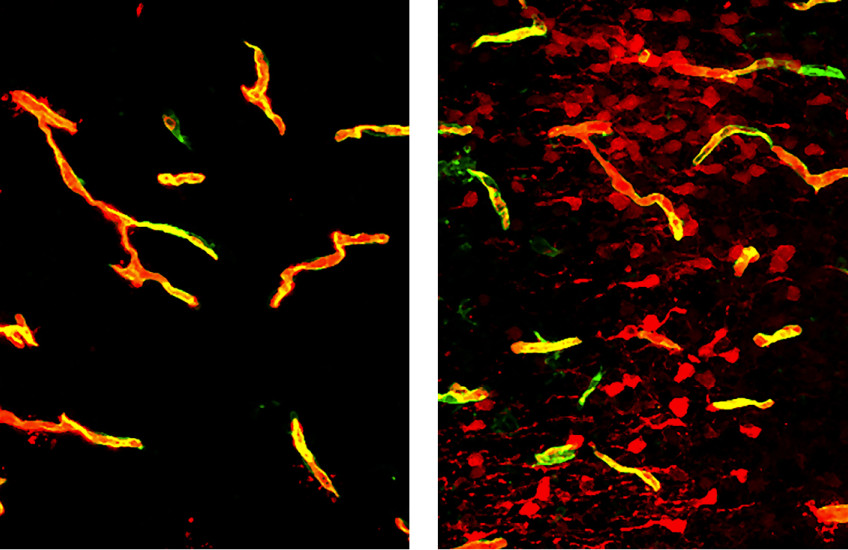 Unlocking the barrier