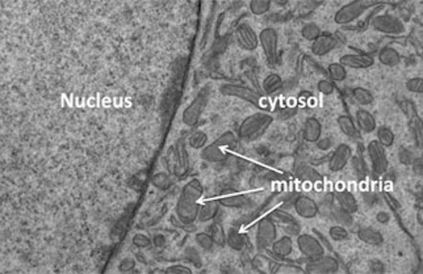 A New—and Reversible—Cause of Aging
