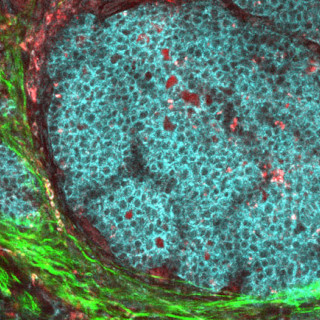 A round cluster of blue cells surrounded by bright green and dark red tissue