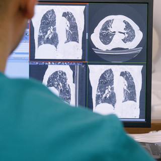 A radiologist in a green shirt looks at a screen showing four images of CT lung scans; a white CT scanner appears blurred in the background. 