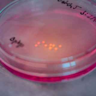 A photo of a petri dish with nine brain organoids, which look like small, white balls, resting on the bottom.
