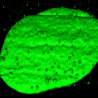 Glowing green blobs of DNA emerging from the nucleus of a human cell in a lab dish.