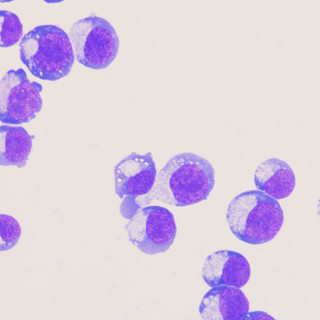 About two dozen cells are seen under a microscope. Part of each cell is stained purple like a half-moon.