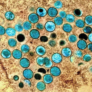 Teal-colored, speckled speres in a textured brown background.