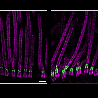 Two collections of about 10 fluorescently labeled cilia under a microscope look like long parallel strands with a short green cuff toward the bottom end.