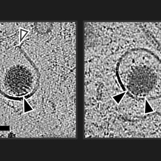 Cryo-electron microscopy views of a round rotavirus enclosed in a membrane-bound compartment. White arrows indicate where viral proteins have created an opening in the membrane.