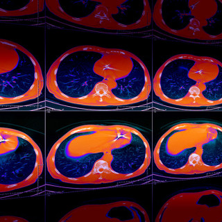 Multiple rows of 2D slices from a chest CT scan