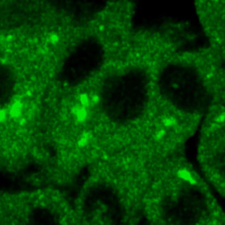 Microscopic image of cells, in green against a black background, many with small, bright fluorescent spots.