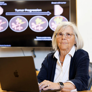Joan Brugge sits at a desk with a laptop computer in front of a monitor showing a diagram labeled “Tumor Progression.”