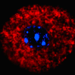 Microscope image of neurons after allergen exposure.