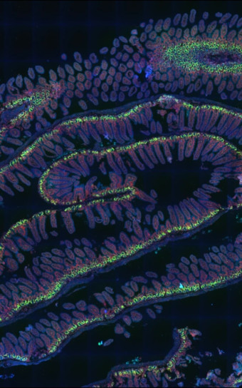 A section of mouse small intestine following radiation exposure shows glowing green p53