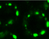 Fluorescent microscope image shows dotted green rings against a black backdrop