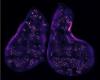 image of the thymus gland