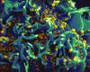 HIV Vaccine Takes Big Step