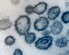 Microscope image of virus particles in blue against a pale background