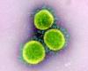 Three virus particles artificially colored green against a pink background