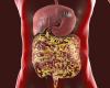 Gut bacteria in human intestines
