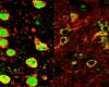 Side by side microscopy images with REST protein in fluorescent green