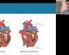 screen grab of Chang on video screen and slide with digital illustrations of a heart