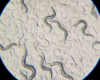 worms squiggle across a microscope slide