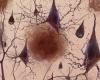 Brain Drain